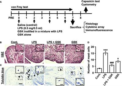 TRPV4 activation prevents lipopolysaccharide-induced painful bladder hypersensitivity in rats by regulating immune pathways